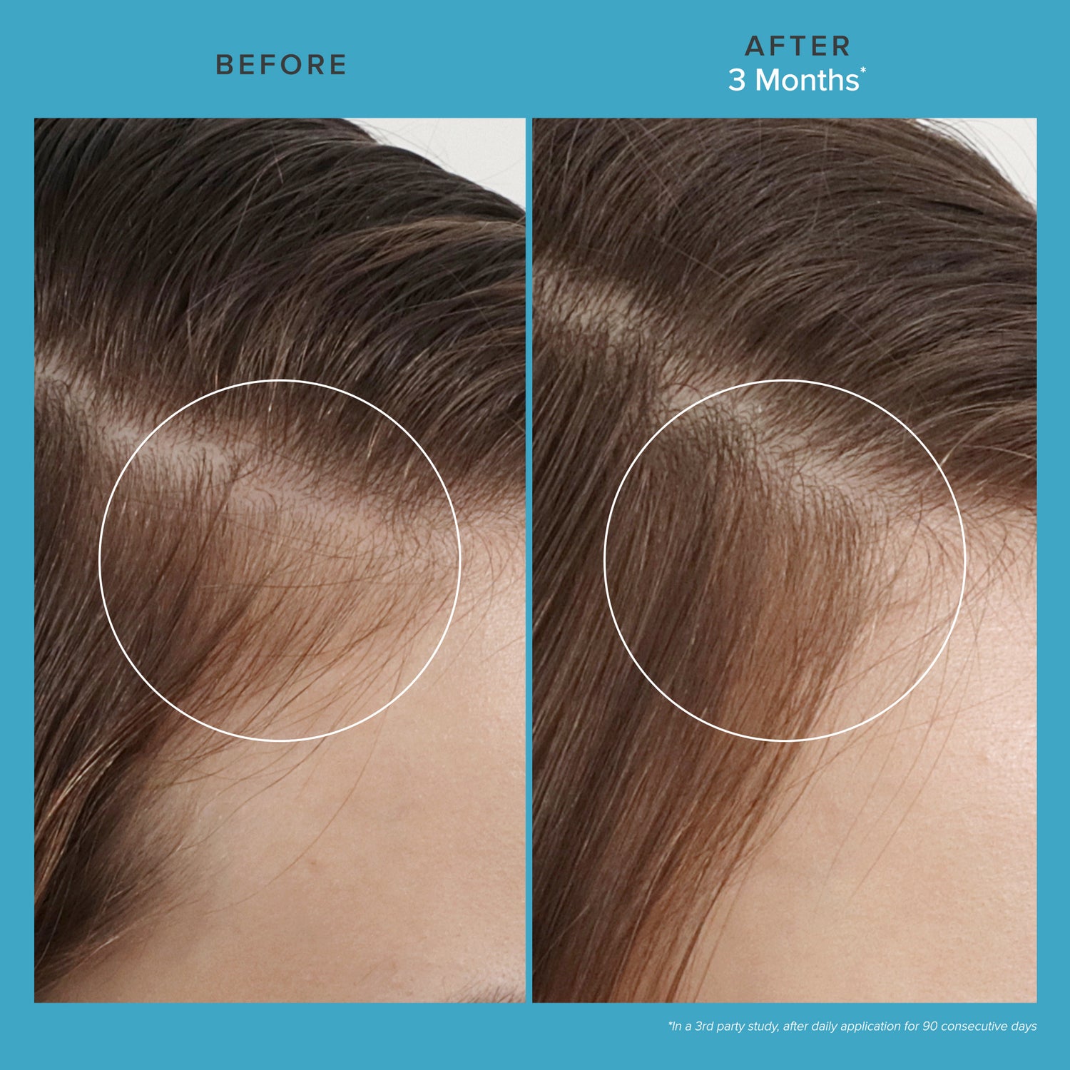 Scalp Care Revitalizing Treatment