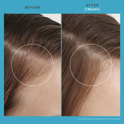 Scalp Care Revitalizing Treatment